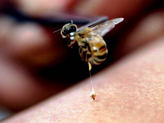 Matthew Davies image of a bee stinging someone