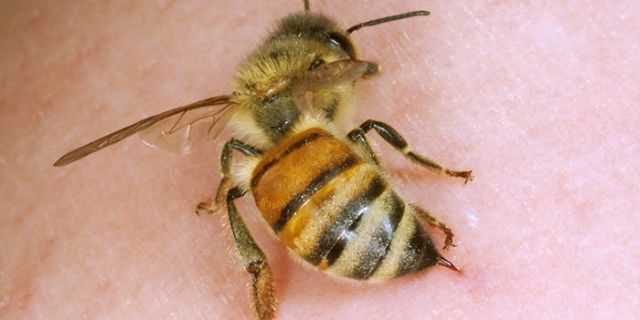 Matthew Davies image of a bee stinging someone